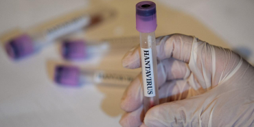 hantavirus-2459284-1024x576-1.jpg